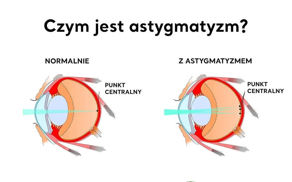 Objawy pogorszenia wzroku, które mogą zaskoczyć – sprawdź, czy je masz