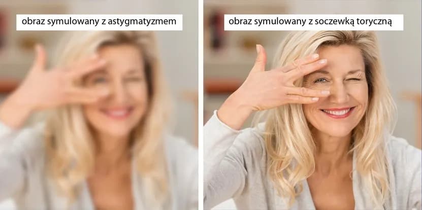Soczewki toryczne - co to znaczy i jak mogą poprawić twoje widzenie?